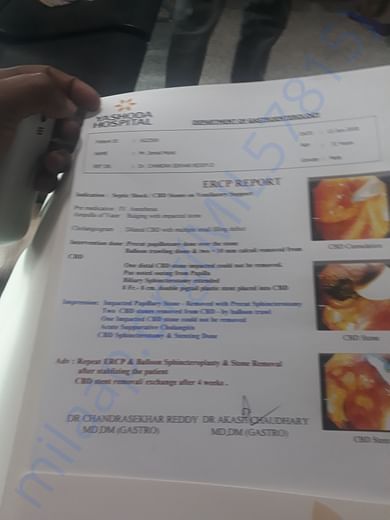 Ercp report which is done