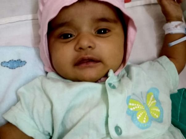 Help 1-month-old Baby Sharda Undergo A Surgery
