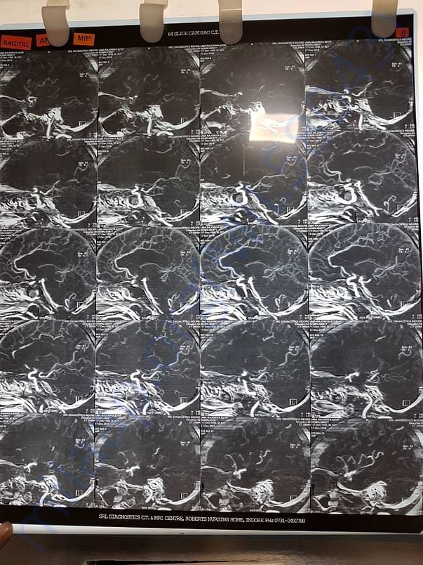 Xray1