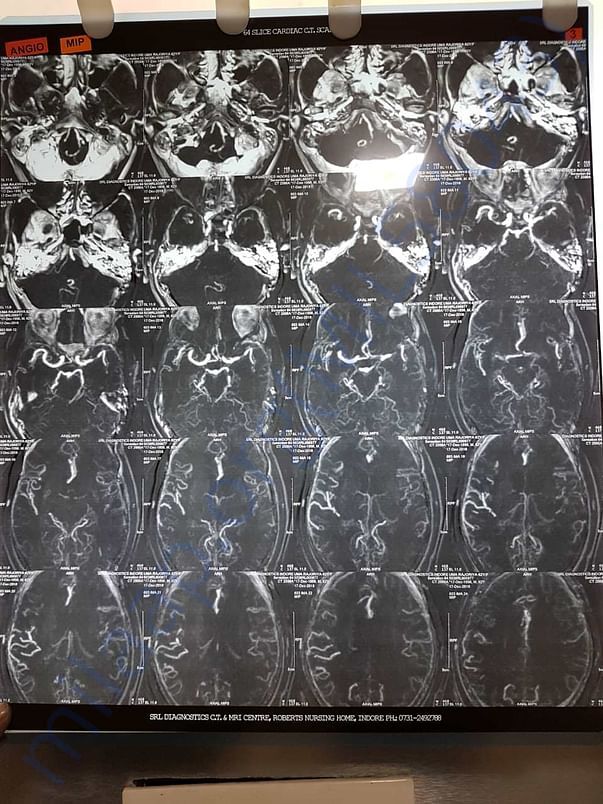 Xray2