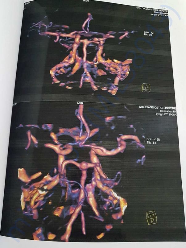Xray4