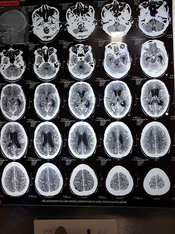 Xray5