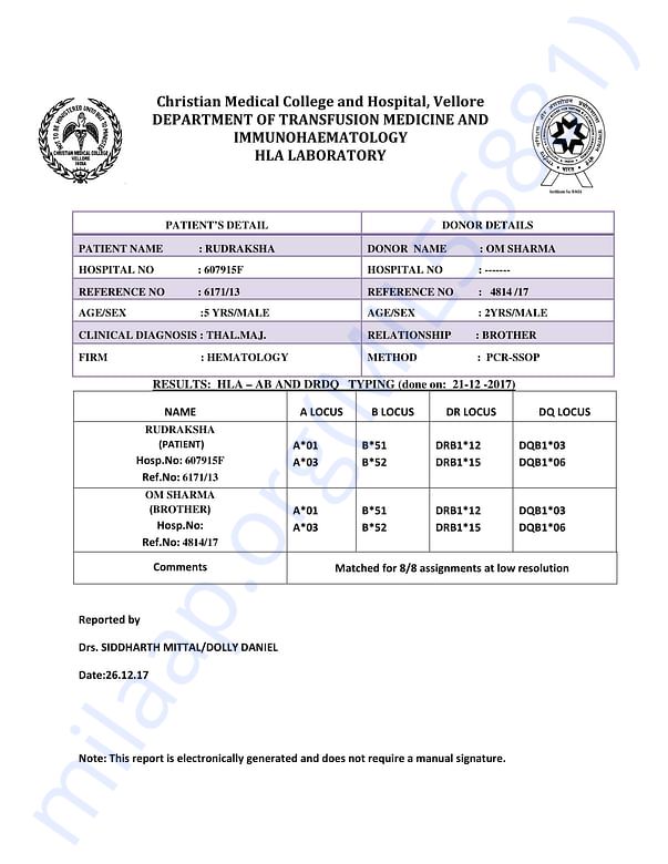 HLA Report