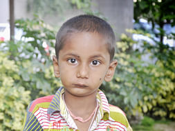 Auto Driver's 4-Year-Old Who Can't Even Open His Mouth Needs Surgery