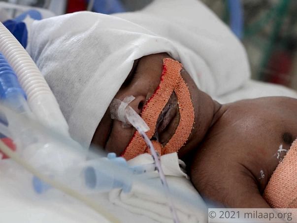 Help Baby of valli to fight disease