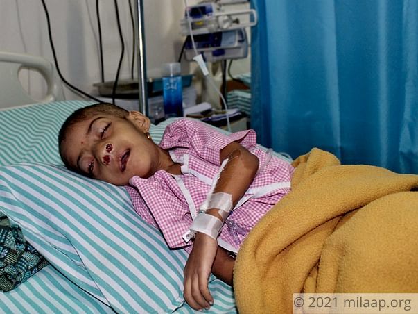 Baby Charitha needs your help to undergo her treatment