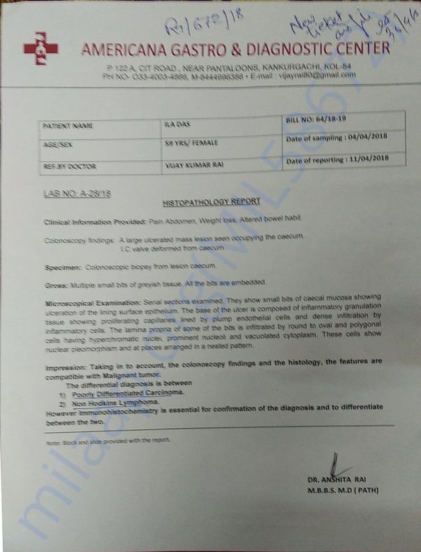 Colon Cancer Report of Ila Das