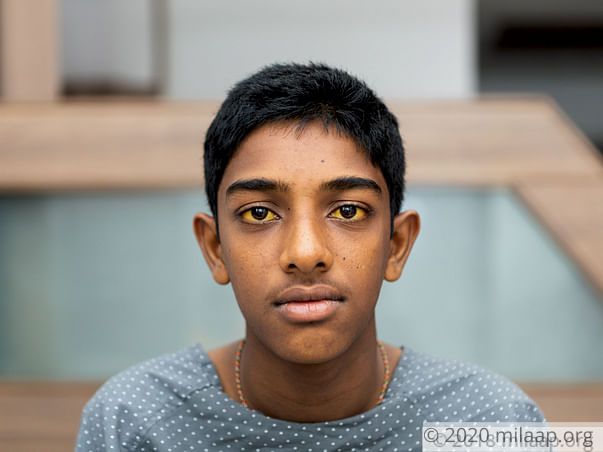 Liver Transplant Is The Only Way To Cure This Teenager Of Rare Disease