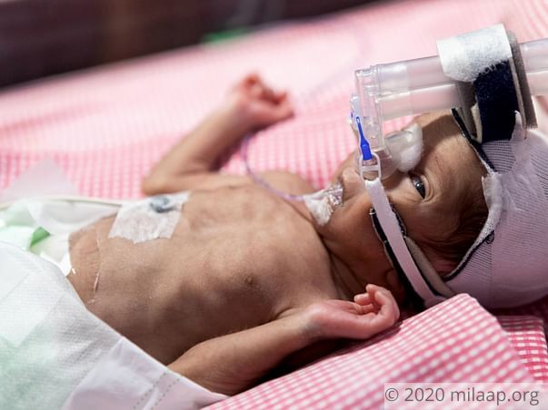 Help Baby of Mamatha to fight disease
