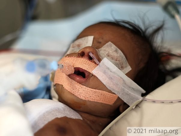 Baby of Manjula needs your help to survive