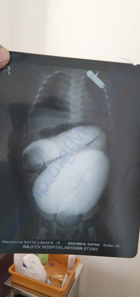 X-ray