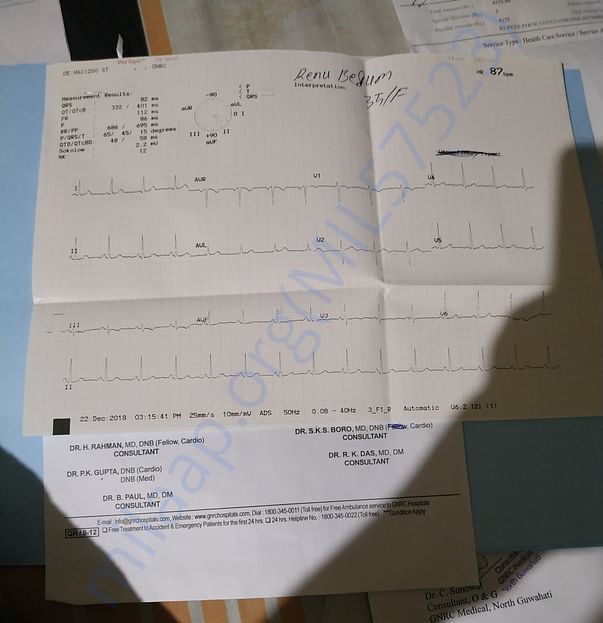 ECG