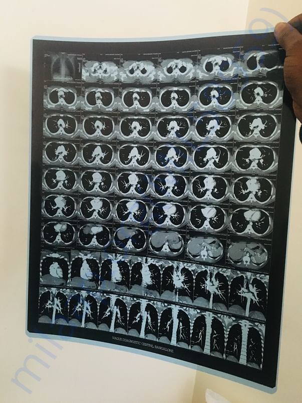 Scanning report