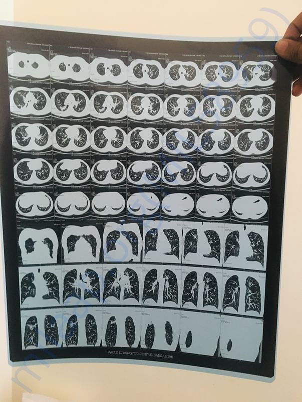 Scanning report 1