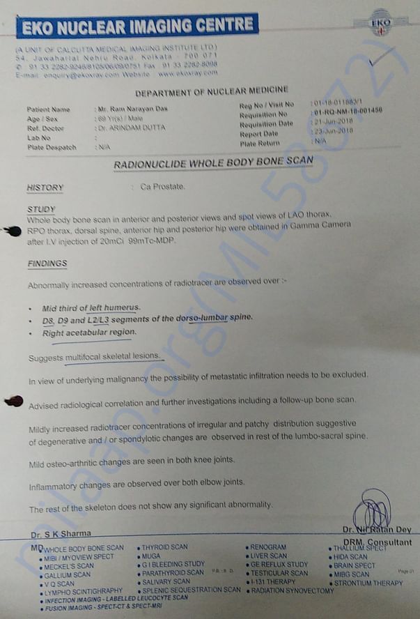 Bone Scan Report of RAM NARAYAN DAS