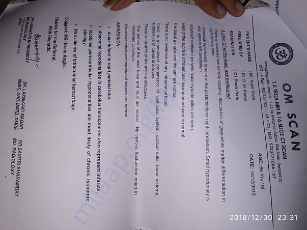 CT Scan report.