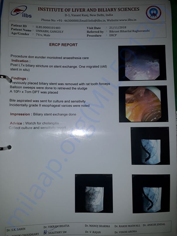 Stent replacement