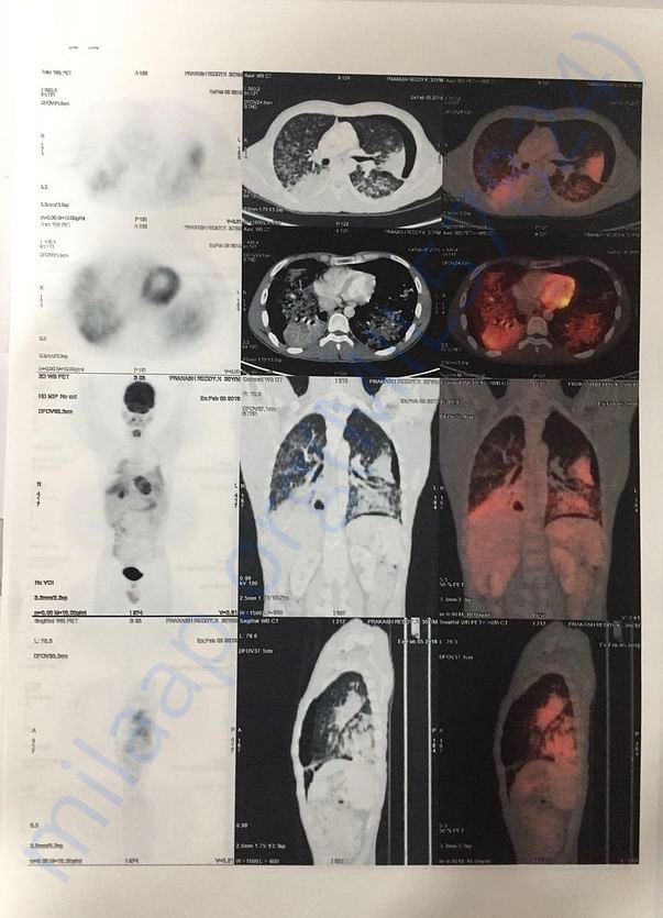 Pet scan page 4