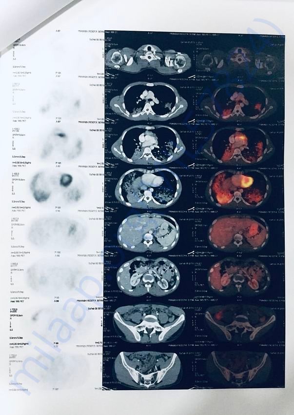 Pet scan page 5