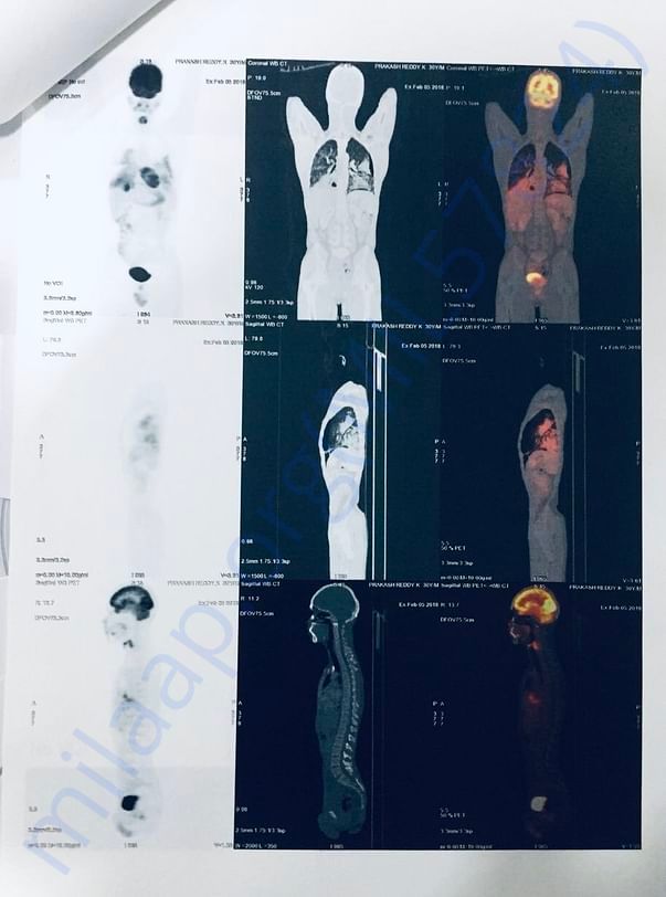 Pet scan page 6