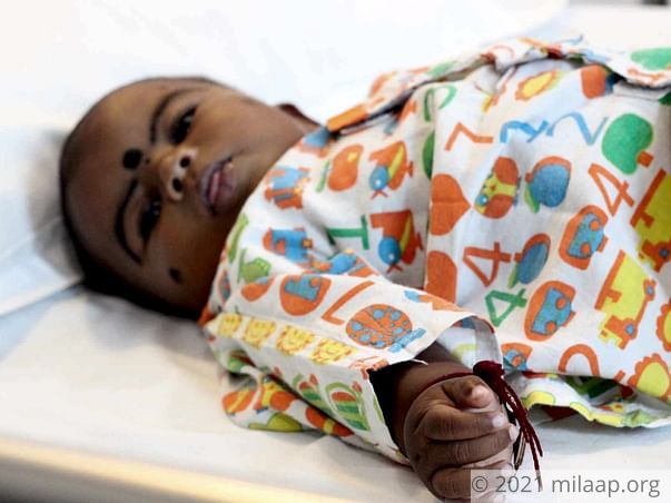 This 9-Month-Old Baby Is Running Out Of Time To Get A Heart Surgery
