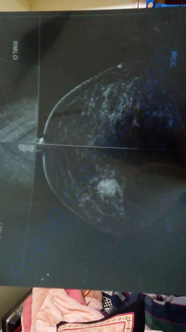 XRay