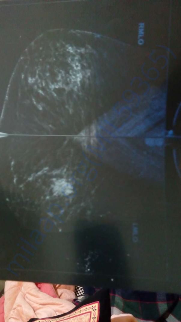 Xray
