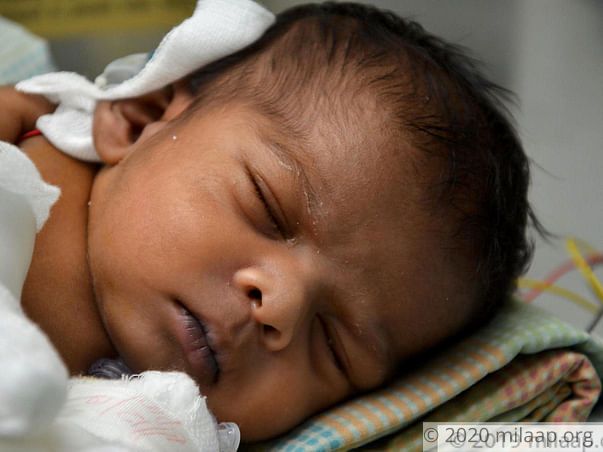 Baby of vijalakshmi needs your help to survive