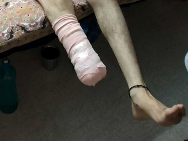 Help Ahmad Be Normal Again