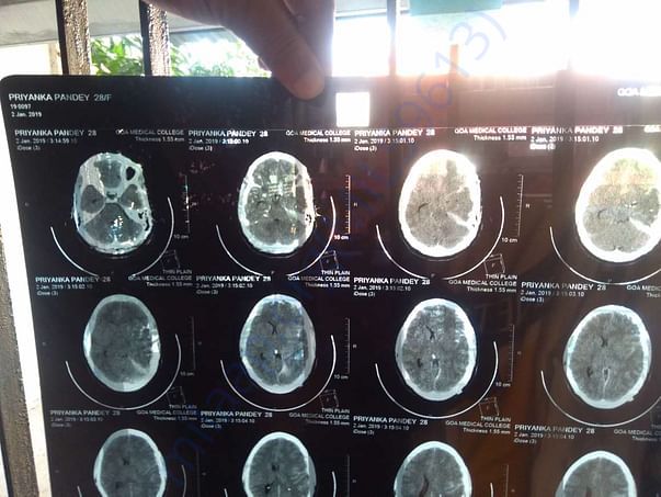 X-ray