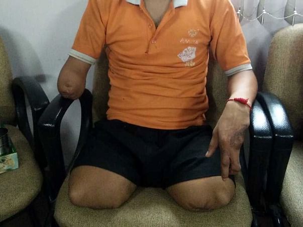Help Suraj Walk Again