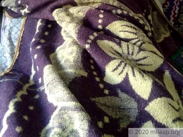 Maya kanjiyani needs your help to undergo her treatment