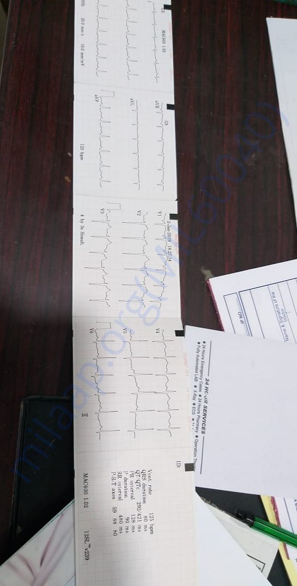 ECG report