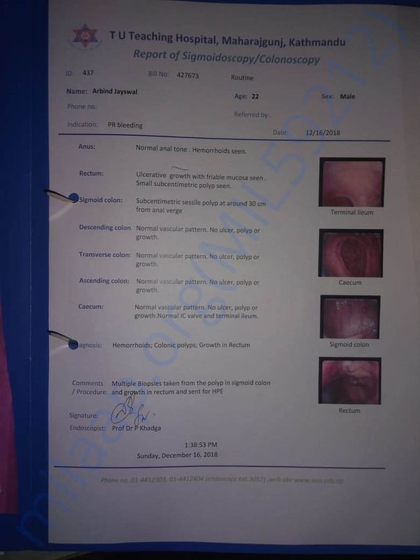 Report of Sigmoidoscopy/Colonoscopy