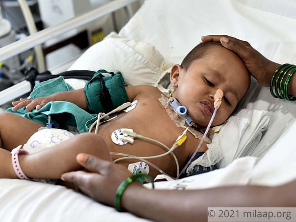 Tejas Can't Breathe Due To A Rare Disease, He Needs Treatment