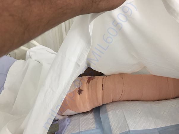 Patient picture
