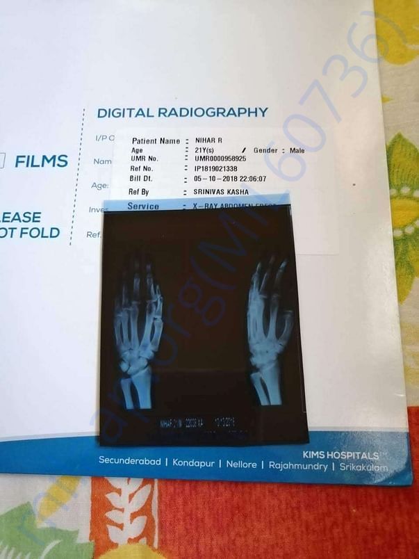 See my brother document