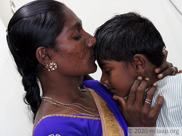 Gowtham Congenital needs your help to fight cardiac problem