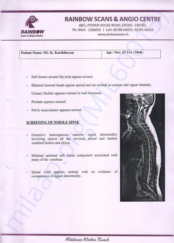 MRI P2