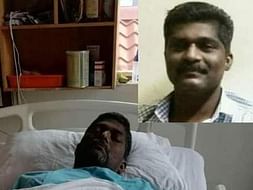 CHRONIC LIVER DISEASE (EMERGENCY LIVER TRANSPLANTATION)