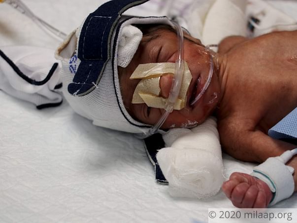 Baby of Revathy needs your help to survive