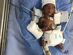 Help My Premature Baby Recover