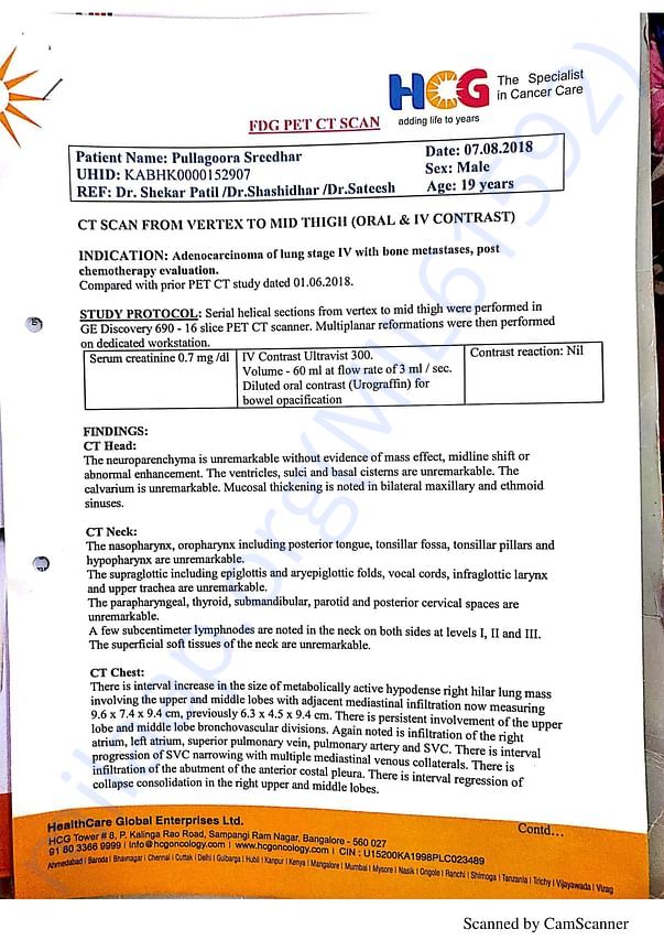 CT Scan Report 1
