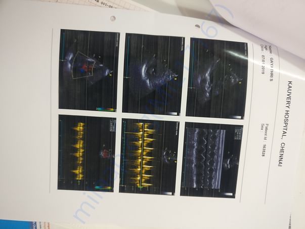 Latest Report 6
