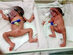 Help my Premature Babies Recover from Ventilator