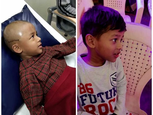 Help 5-year-old Jaidev Fight Brain Tumour