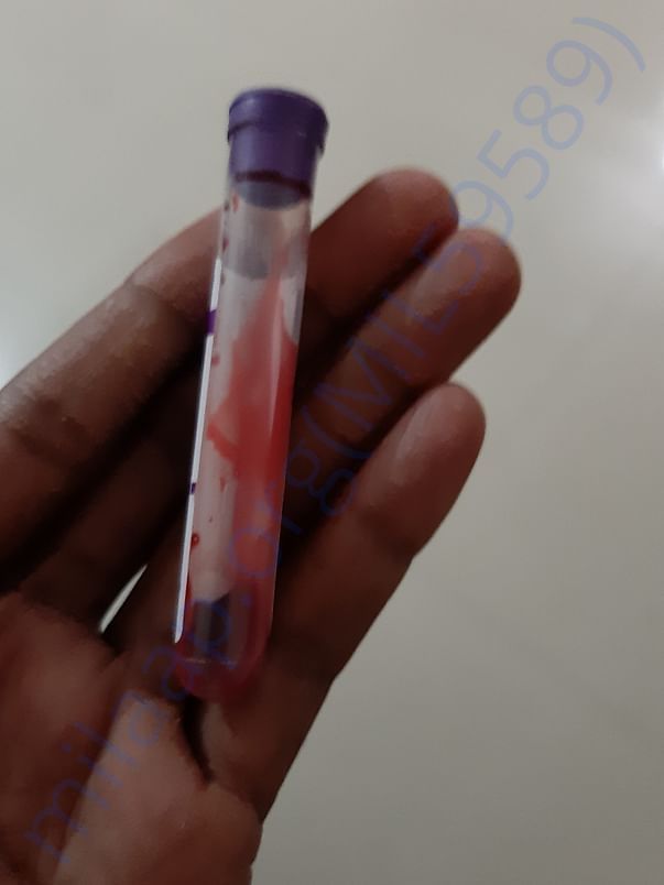 Blood samples