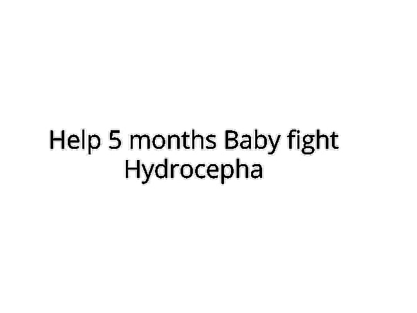 Help 5 months Baby fight Hydrocepha