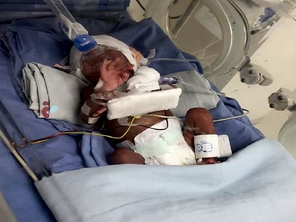 Help My Premature Baby Recover