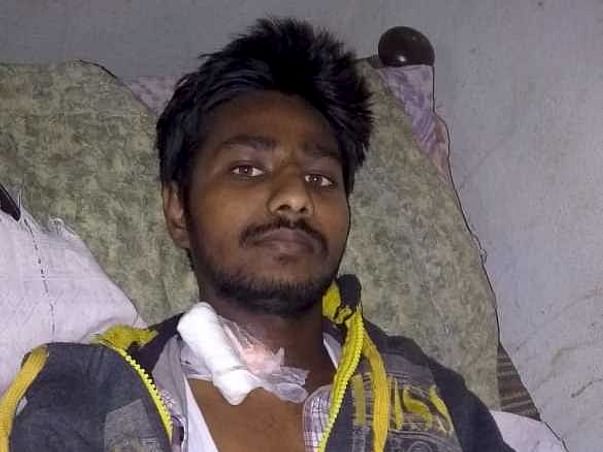 Help Chinna Undergo A Kidney Transplant